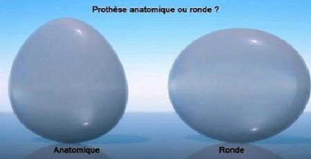 comment choisir protheses mammaires