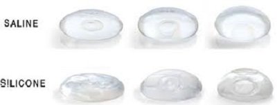 comment choisir ses protheses mammaires